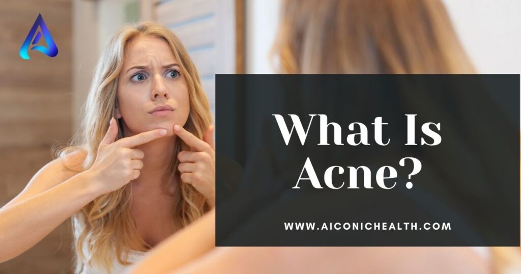 What Is Acne