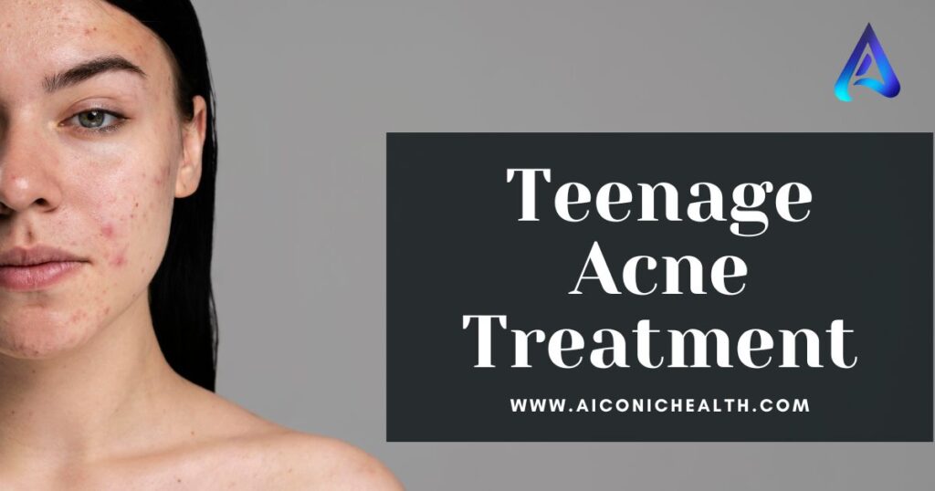 Teenage Acne Treatment