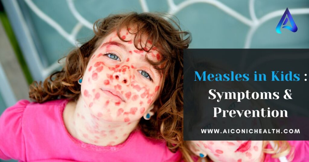 Measles in Kids