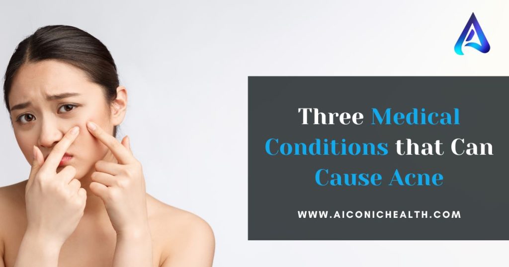 Medical Conditions that Can Cause Acne